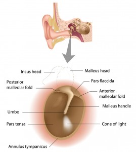 myringotomy and ear tubes