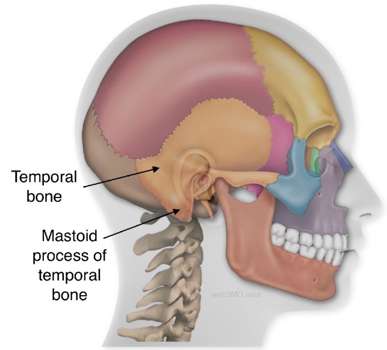 Tympanoplasty and Mastoidectomy (Tympanomastoidectomy)