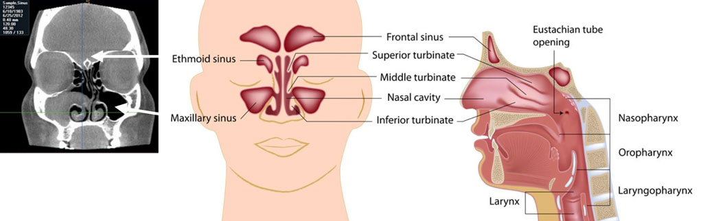 CT Scan sinus natomy