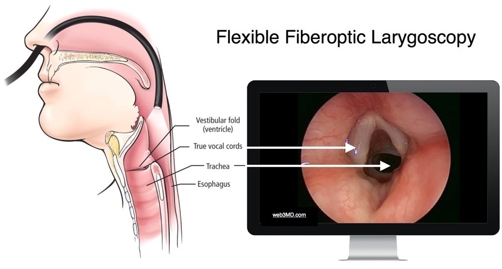 vocal cords larynx