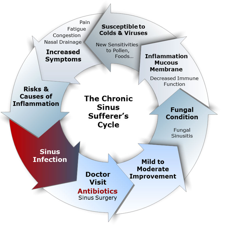 recurring nasal congestion