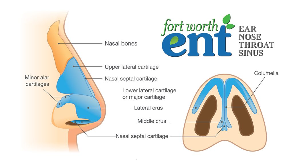 nasotracheal airway