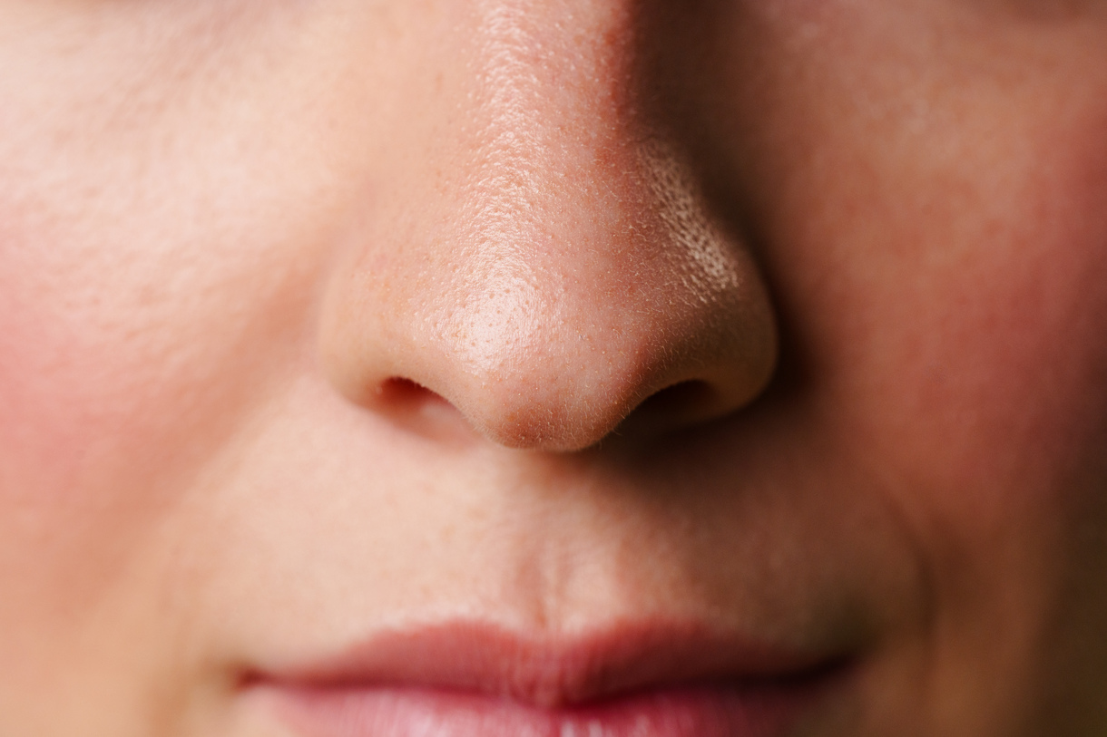 Deviated Septum