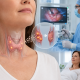 Parathyroidectomy