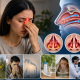 What Is Nasal Obstruction