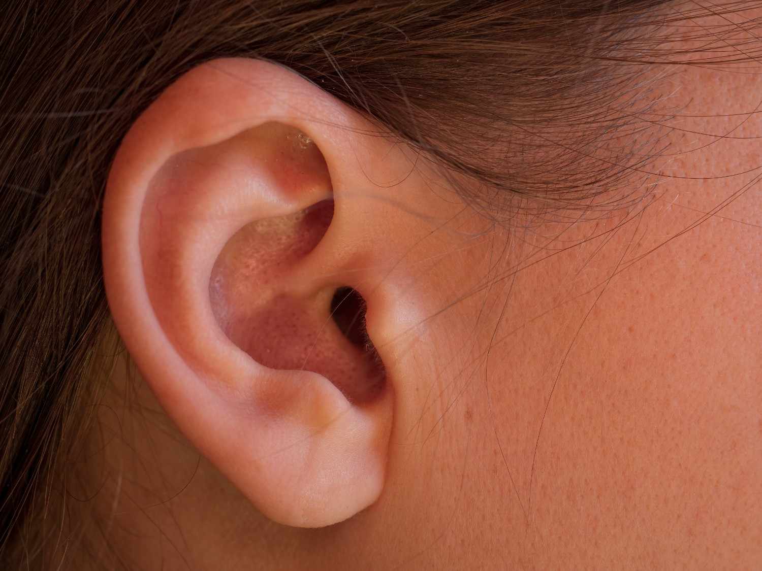 Perforated Eardrum