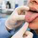 Lip and tongue lesion examination