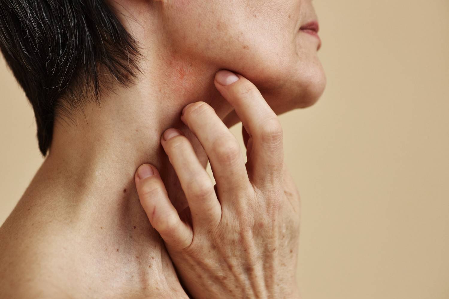 Parotid Tumors
